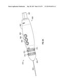 OPHTHALMIC SURGICAL SYSTEMS, METHODS, AND DEVICES diagram and image