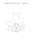 Clamp With External Support diagram and image