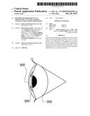 METHODS FOR FORMATION OF AN OPHTHALMIC LENS WITH AN INSERT UTILIZING     VOXEL-BASED LITHOGRAPHY diagram and image