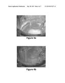 FLUID CAPTURE OF NANOPARTICLES diagram and image