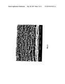 Wound Dressing Comprising Bio-Cellulose and Silver Nanoparticles diagram and image