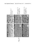 THERMAL BARRIER COATING AND ARTICLE COMPRISING SAME diagram and image