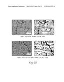 THERMAL BARRIER COATING AND ARTICLE COMPRISING SAME diagram and image