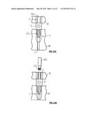 SURGICAL GUIDE SYSTEM FOR DENTAL IMPLANTOLOGY AND METHOD FOR MAKING THE     SAME diagram and image