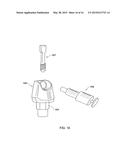 DENTAL BRIDGE ATTACHMENT SYSTEM AND METHOD diagram and image