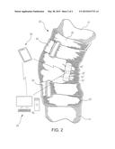 APPARATUS AND METHOD FOR TRAINING MOVEMENTS TO AVOID INJURIES diagram and image