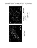 METHOD FOR DETERMINING DISEASE SEVERITY IN TAUOPATHY-RELATED     NEURODEGENERATIVE DISORDERS diagram and image