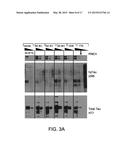 METHOD FOR DETERMINING DISEASE SEVERITY IN TAUOPATHY-RELATED     NEURODEGENERATIVE DISORDERS diagram and image