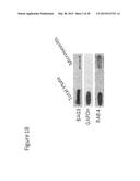 BAG3 AS BIOCHEMICAL SERUM AND TISSUE MARKER diagram and image