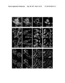 SERINIQUINONES, MELANOMA-SPECIFIC ANTICANCER AGENTS diagram and image