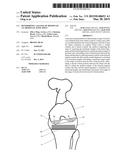 DETERMINING A RANGE OF MOTION OF AN ARTIFICIAL KNEE JOINT diagram and image