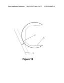 DETERMINING A RANGE OF MOTION OF AN ARTIFICIAL KNEE JOINT diagram and image