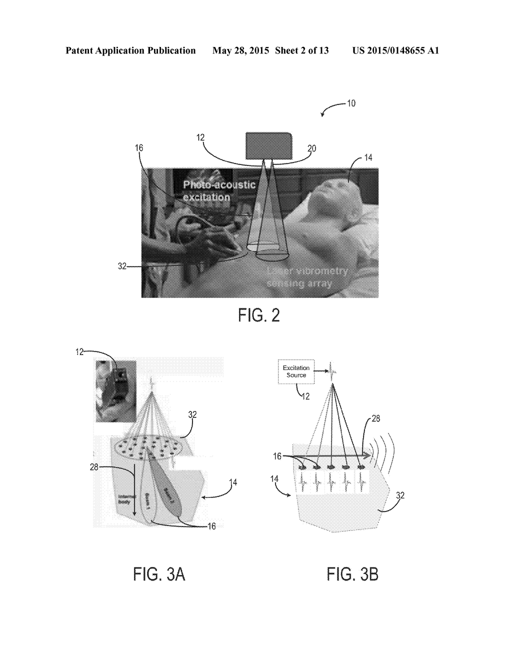 SYSTEM AND METHOD FOR NON-CONTACT ULTRASOUND - diagram, schematic, and image 03