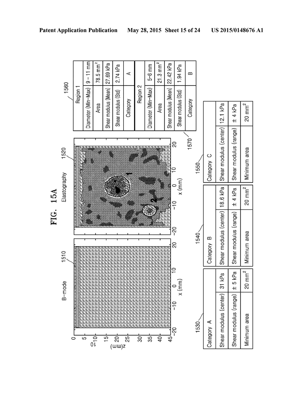 METHOD AND ULTRASOUND APPARATUS FOR MARKING TUMOR ON ULTRASOUND     ELASTOGRAPHY IMAGE - diagram, schematic, and image 16