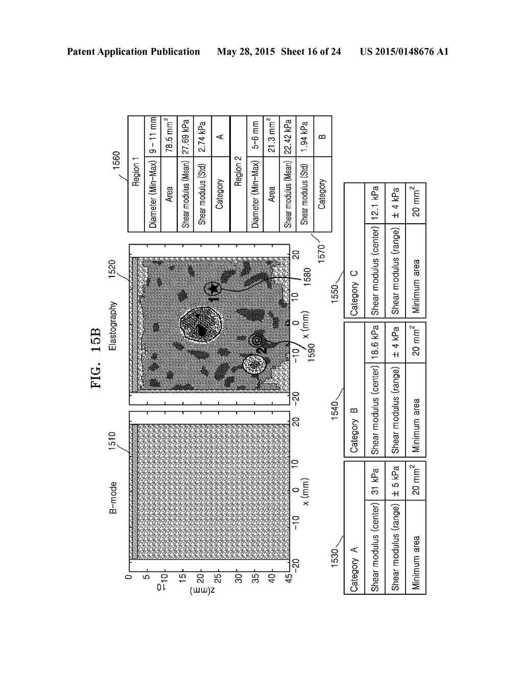 METHOD AND ULTRASOUND APPARATUS FOR MARKING TUMOR ON ULTRASOUND     ELASTOGRAPHY IMAGE - diagram, schematic, and image 17