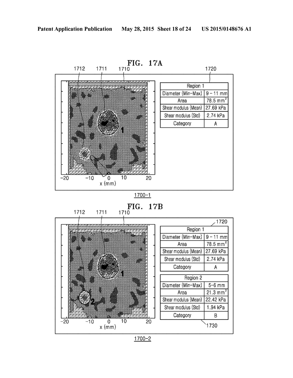 METHOD AND ULTRASOUND APPARATUS FOR MARKING TUMOR ON ULTRASOUND     ELASTOGRAPHY IMAGE - diagram, schematic, and image 19