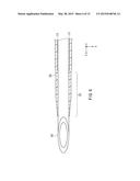 INDWELLING NEEDLE DEVICE diagram and image