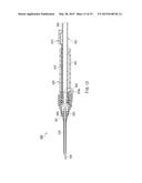 INDWELLING NEEDLE DEVICE diagram and image