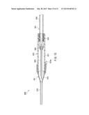 INDWELLING NEEDLE DEVICE diagram and image