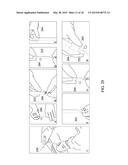 DRUG DELIVERY DEVICE WITH RETAINING MEMBER diagram and image