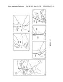 DRUG DELIVERY DEVICE WITH RETAINING MEMBER diagram and image