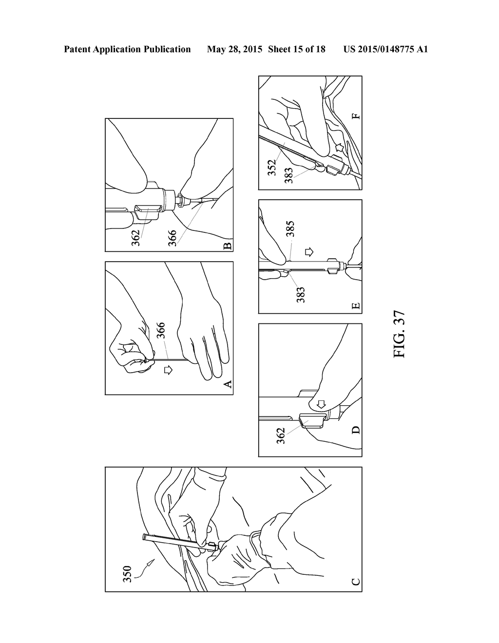 DRUG DELIVERY DEVICE WITH RETAINING MEMBER - diagram, schematic, and image 16