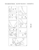 DRUG DELIVERY DEVICE WITH RETAINING MEMBER diagram and image