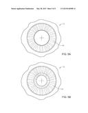 ADJUSTING LASER TREATMENT IN RESPONSE TO CHANGES IN THE EYE diagram and image