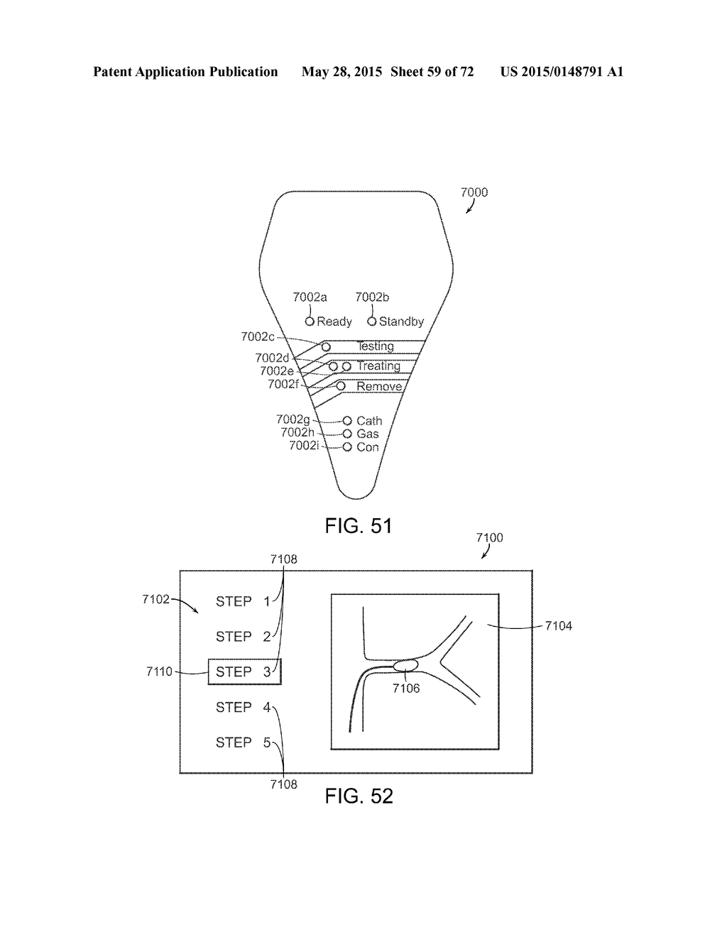 SYSTEMS, DEVICES AND METHODS FOR CRYOGENIC RENAL NEUROMODULATION - diagram, schematic, and image 60