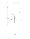 METHOD FOR FEMUR RESECTION ALIGNMENT APPROXIMATION IN HIP REPLACEMENT     PROCEDURES diagram and image