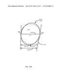 METHOD FOR FEMUR RESECTION ALIGNMENT APPROXIMATION IN HIP REPLACEMENT     PROCEDURES diagram and image