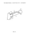 METHOD FOR FEMUR RESECTION ALIGNMENT APPROXIMATION IN HIP REPLACEMENT     PROCEDURES diagram and image