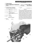 PATIENT-SPECIFIC ACETABULAR ALIGNMENT GUIDE AND METHOD diagram and image