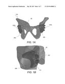 PATIENT-SPECIFIC ACETABULAR ALIGNMENT GUIDE AND METHOD diagram and image