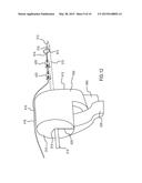 APPARATUS FOR DELIVERING AND ANCHORING IMPLANTABLE MEDICAL DEVICES diagram and image