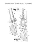 POLYAXIAL BONE SCREW WITH HELICALLY WOUND CAPTURE CONNECTION diagram and image