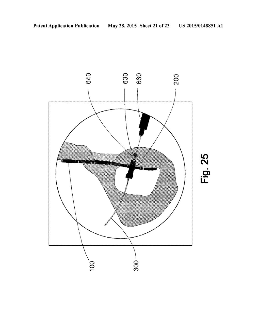 Devices, Systems, and Methods for Acetabulum Repair - diagram, schematic, and image 22