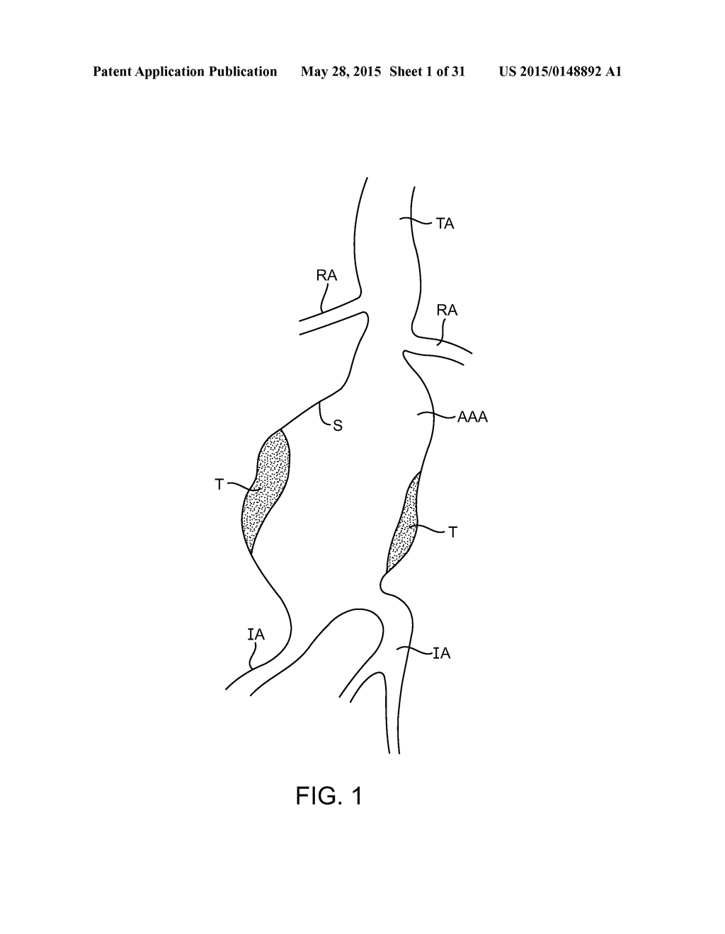 SEALING APPRATUS AND METHODS OF USE - diagram, schematic, and image 02