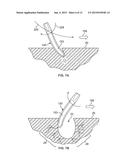 SYSTEMS AND METHODS FOR TREATING A GROUND SURFACE diagram and image