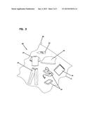 METHOD OF TREATING ARTICLES WITH CARBON DIOXIDE diagram and image