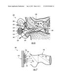 Monitoring Devices with Wireless Earpiece Modules diagram and image