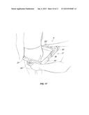 Method and system for optimized selection of a bicycle saddle pertaining     to a population of different saddles diagram and image