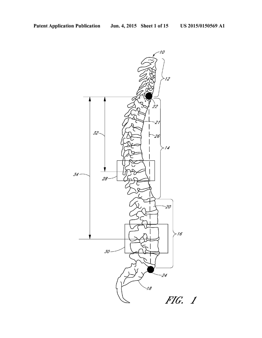 DEVICES AND METHODS FOR INTRA-OPERATIVE SPINAL ALIGNMENT - diagram, schematic, and image 02