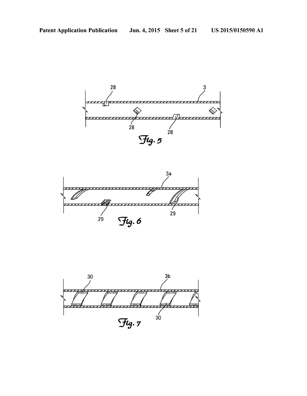 MATERIAL REMOVAL DEVICE AND METHOD OF USE - diagram, schematic, and image 06