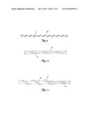 MATERIAL REMOVAL DEVICE AND METHOD OF USE diagram and image