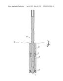 MATERIAL REMOVAL DEVICE AND METHOD OF USE diagram and image