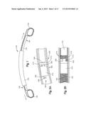 REMOTELY ADJUSTABLE TISSUE DISPLACEMENT DEVICE diagram and image