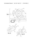 REMOTELY ADJUSTABLE TISSUE DISPLACEMENT DEVICE diagram and image