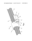 REMOTELY ADJUSTABLE TISSUE DISPLACEMENT DEVICE diagram and image