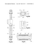 REMOTELY ADJUSTABLE TISSUE DISPLACEMENT DEVICE diagram and image